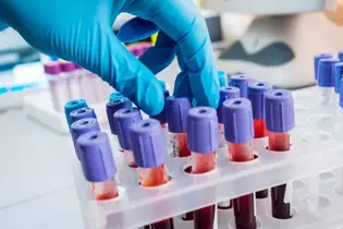 CMV PCR Testi Nedir?