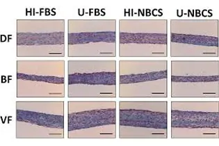 FBS Seçerken Heat Inactivated Olması Önemli mi?
