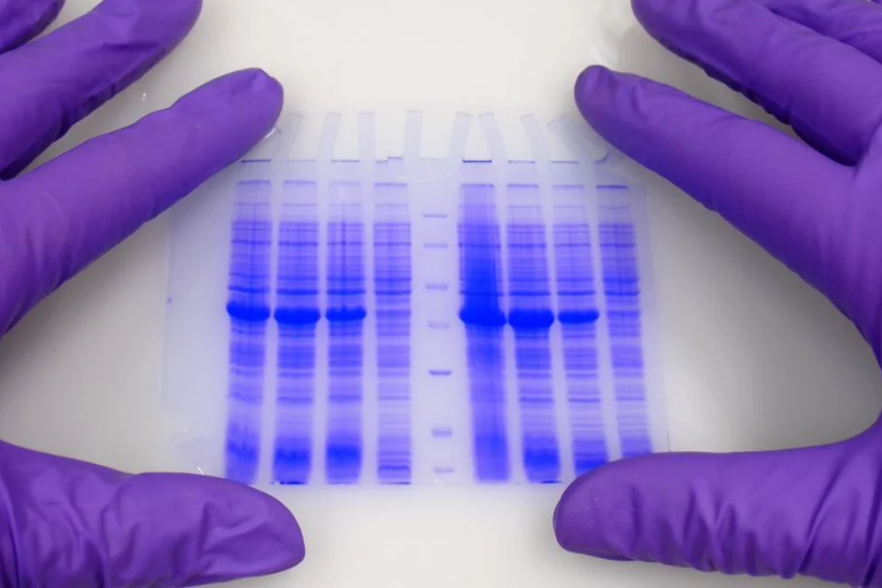 Protein Elektroforezi